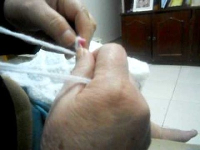 Ponto abacaxi em trico