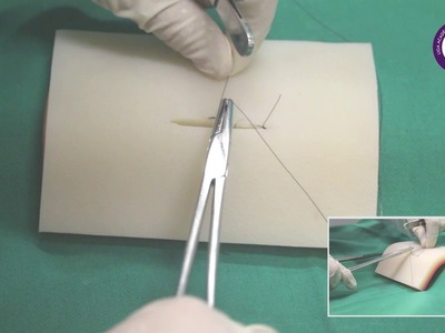 Sutura Intradérmica