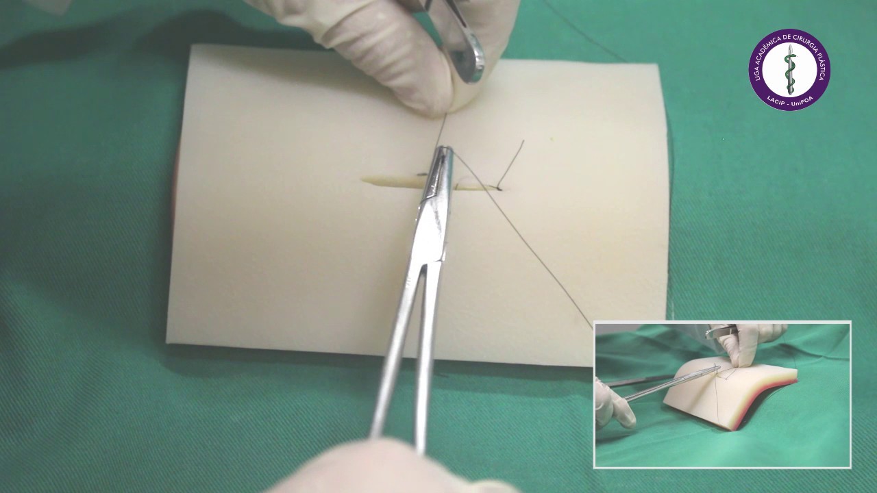 Sutura Intradérmica